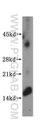 SYNJ2BP Antibody in Western Blot (WB)