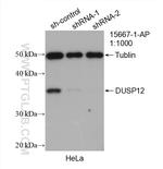 DUSP12 Antibody in Western Blot (WB)