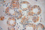 VPS25 Antibody in Immunohistochemistry (Paraffin) (IHC (P))