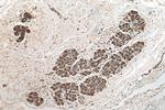 VPS25 Antibody in Immunohistochemistry (Paraffin) (IHC (P))