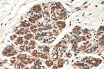 VPS25 Antibody in Immunohistochemistry (Paraffin) (IHC (P))