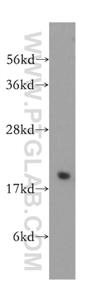 VPS25 Antibody in Western Blot (WB)