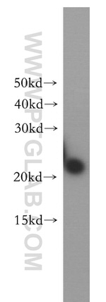 VPS25 Antibody in Western Blot (WB)