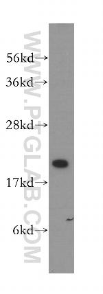 VPS25 Antibody in Western Blot (WB)