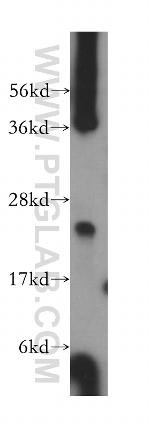 ARD1B Antibody in Western Blot (WB)