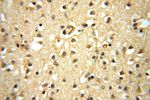 PPIL3 Antibody in Immunohistochemistry (Paraffin) (IHC (P))