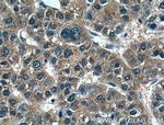 PMVK Antibody in Immunohistochemistry (Paraffin) (IHC (P))