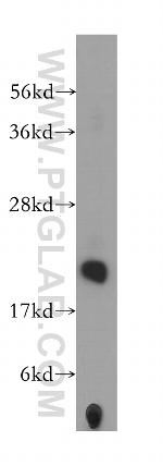 PMVK Antibody in Western Blot (WB)