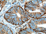 CD44 Antibody in Immunohistochemistry (Paraffin) (IHC (P))