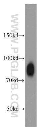 CD44 Antibody in Western Blot (WB)