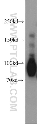 CD44 Antibody in Western Blot (WB)