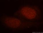 HEXIM1 Antibody in Immunocytochemistry (ICC/IF)