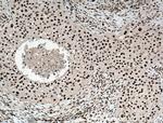 HEXIM1 Antibody in Immunohistochemistry (Paraffin) (IHC (P))