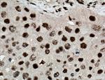 HEXIM1 Antibody in Immunohistochemistry (Paraffin) (IHC (P))