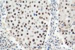 HEXIM1 Antibody in Immunohistochemistry (Paraffin) (IHC (P))