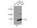 HEXIM1 Antibody in Immunoprecipitation (IP)