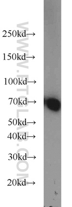 HEXIM1 Antibody in Western Blot (WB)