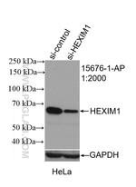 HEXIM1 Antibody in Western Blot (WB)