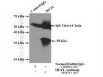 HEYL Antibody in Immunoprecipitation (IP)