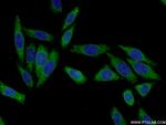 KHK Antibody in Immunocytochemistry (ICC/IF)