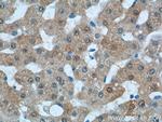 KHK Antibody in Immunohistochemistry (Paraffin) (IHC (P))