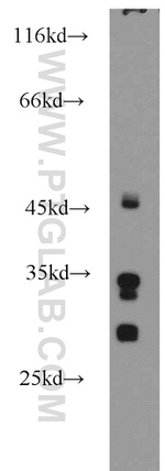 KHK Antibody in Western Blot (WB)