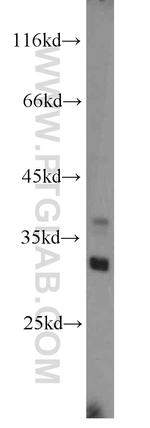 KHK Antibody in Western Blot (WB)