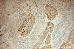 MRPL45 Antibody in Immunohistochemistry (Paraffin) (IHC (P))