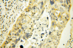 MRPL45 Antibody in Immunohistochemistry (Paraffin) (IHC (P))