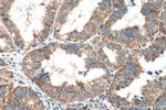 MRPL45 Antibody in Immunohistochemistry (Paraffin) (IHC (P))