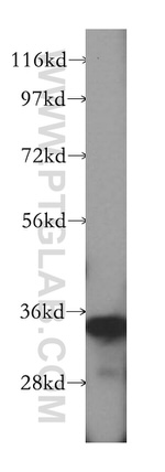 MRPL45 Antibody in Western Blot (WB)