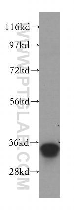 MRPL45 Antibody in Western Blot (WB)