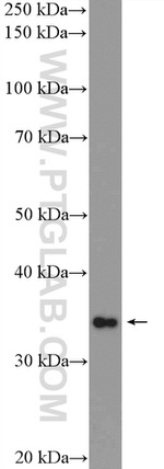 MRPL45 Antibody in Western Blot (WB)