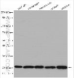 UBE2H Antibody in Western Blot (WB)