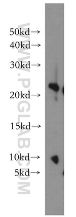 UBE2H Antibody in Western Blot (WB)