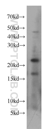 UBE2H Antibody in Western Blot (WB)