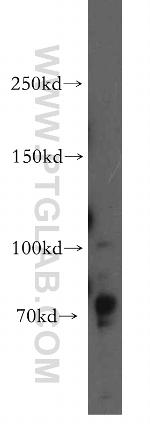 DLG5 Antibody in Western Blot (WB)