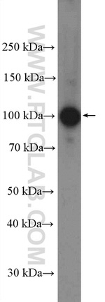 AP2B1 Antibody in Western Blot (WB)