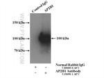 AP2B1 Antibody in Immunoprecipitation (IP)