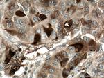 TK1 Antibody in Immunohistochemistry (Paraffin) (IHC (P))