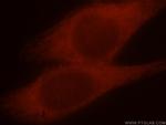 MAP1S Antibody in Immunocytochemistry (ICC/IF)