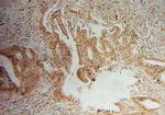 MAP1S Antibody in Immunohistochemistry (Paraffin) (IHC (P))