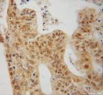 MAP1S Antibody in Immunohistochemistry (Paraffin) (IHC (P))