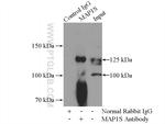 MAP1S Antibody in Immunoprecipitation (IP)