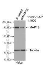 MAP1S Antibody in Western Blot (WB)