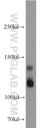 MAP1S Antibody in Western Blot (WB)