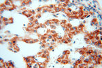 CLPP Antibody in Immunohistochemistry (Paraffin) (IHC (P))