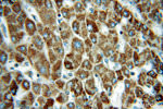 CLPP Antibody in Immunohistochemistry (Paraffin) (IHC (P))