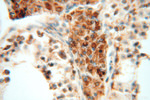 CLPP Antibody in Immunohistochemistry (Paraffin) (IHC (P))