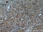 CLPP Antibody in Immunohistochemistry (Paraffin) (IHC (P))